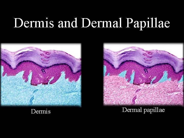 Dermis and Dermal Papillae Dermis Dermal papillae 