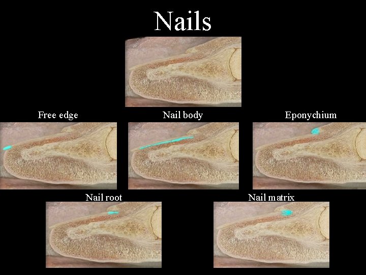 Nails Free edge Nail body Nail root Eponychium Nail matrix 