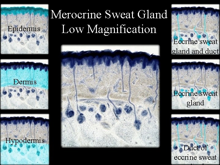 Epidermis Merocrine Sweat Gland Low Magnification Eccrine sweat gland duct Dermis Eccrine sweat gland