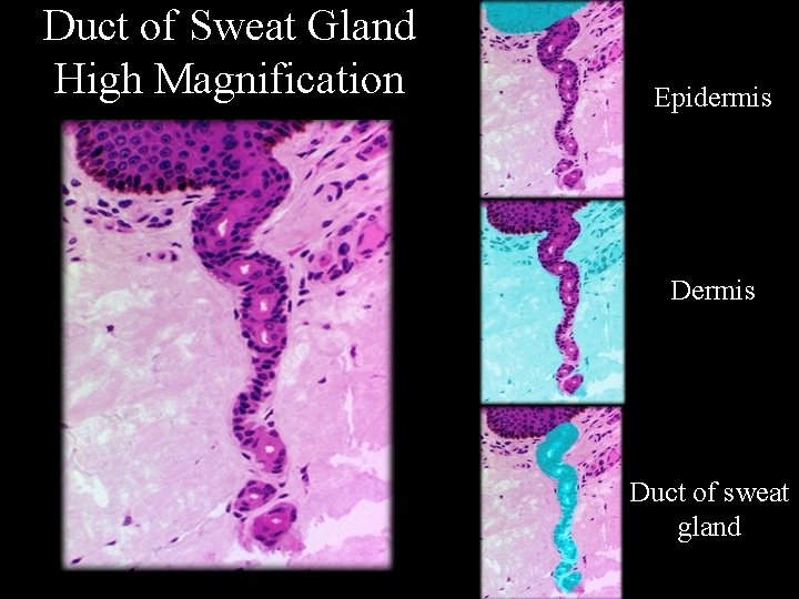 Duct of Sweat Gland High Magnification Epidermis Duct of sweat gland 