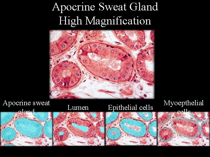 Apocrine Sweat Gland High Magnification Apocrine sweat gland Lumen Epithelial cells Myoepthelial cells 