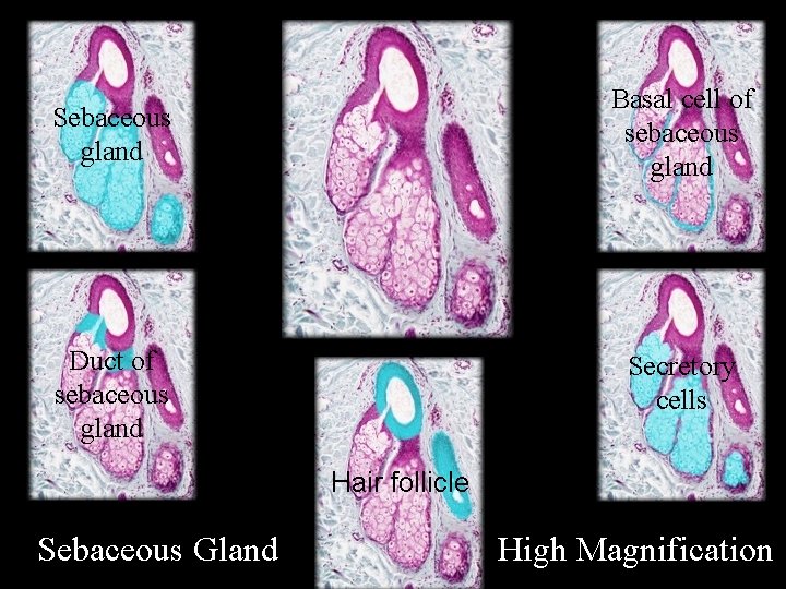 Sebaceous gland Basal cell of sebaceous gland Duct of sebaceous gland Secretory cells Hair