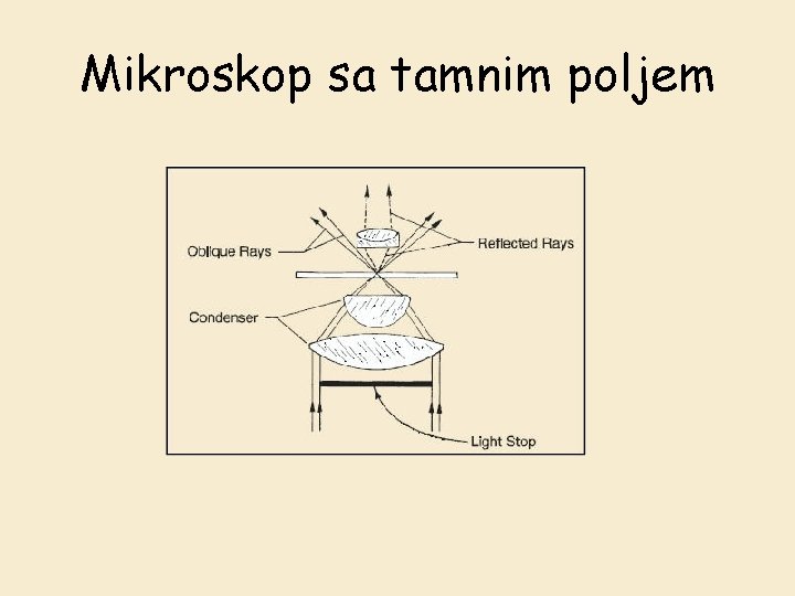 Mikroskop sa tamnim poljem 