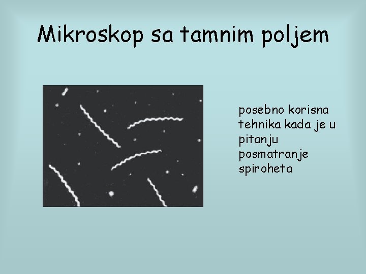 Mikroskop sa tamnim poljem posebno korisna tehnika kada je u pitanju posmatranje spiroheta 