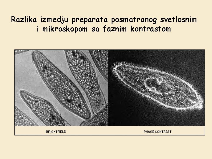 Razlika izmedju preparata posmatranog svetlosnim i mikroskopom sa faznim kontrastom 