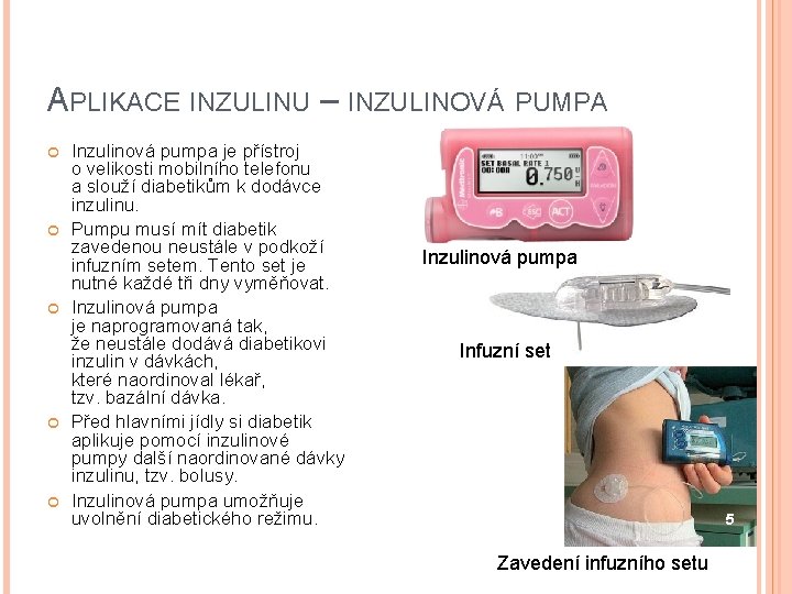 APLIKACE INZULINU – INZULINOVÁ PUMPA Inzulinová pumpa je přístroj o velikosti mobilního telefonu a