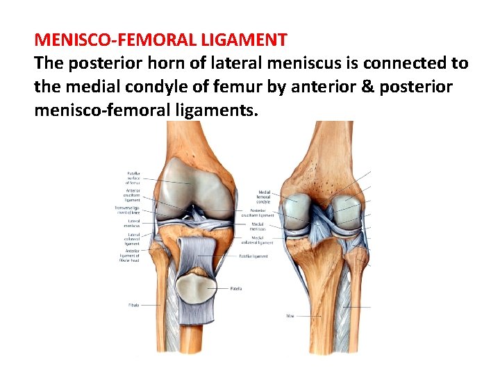 MENISCO-FEMORAL LIGAMENT The posterior horn of lateral meniscus is connected to the medial condyle