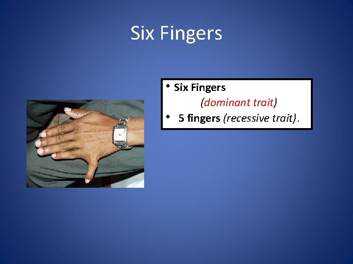 Six Fingers • (dominant trait) 5 fingers (recessive trait). 