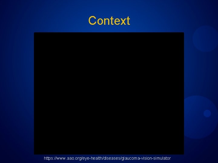 Context https: //www. aao. org/eye-health/diseases/glaucoma-vision-simulator 