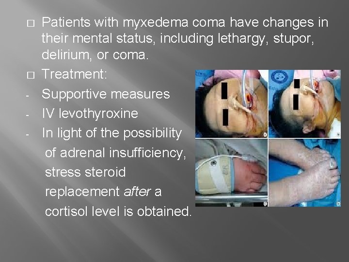 Thyroid Disorders Hussam Al Hawari Md Face Ecnu