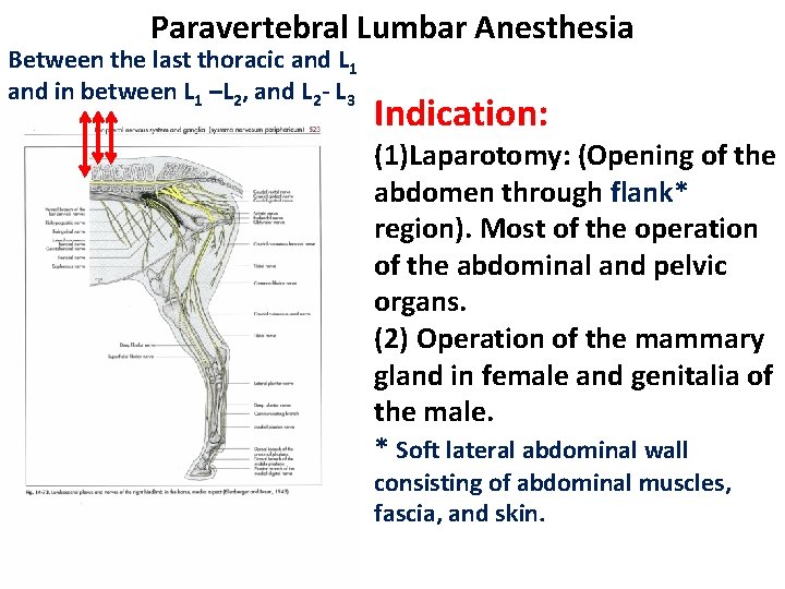 Paravertebral Lumbar Anesthesia Between the last thoracic and L 1 and in between L