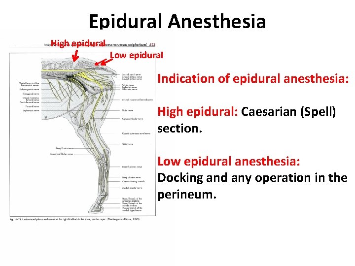 Epidural Anesthesia High epidural Low epidural Indication of epidural anesthesia: High epidural: Caesarian (Spell)