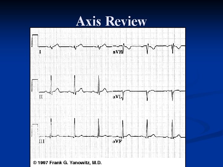 Axis Review 