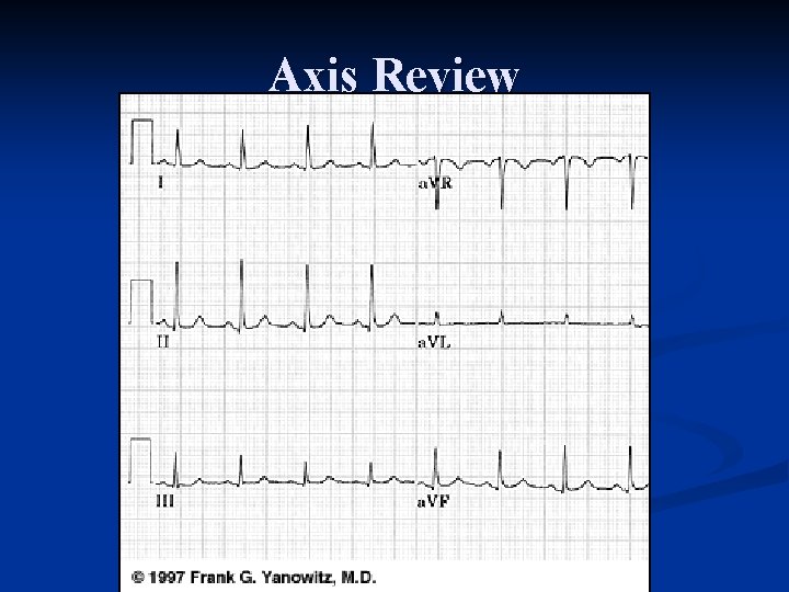 Axis Review 