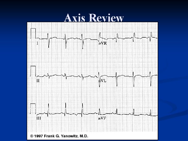 Axis Review 