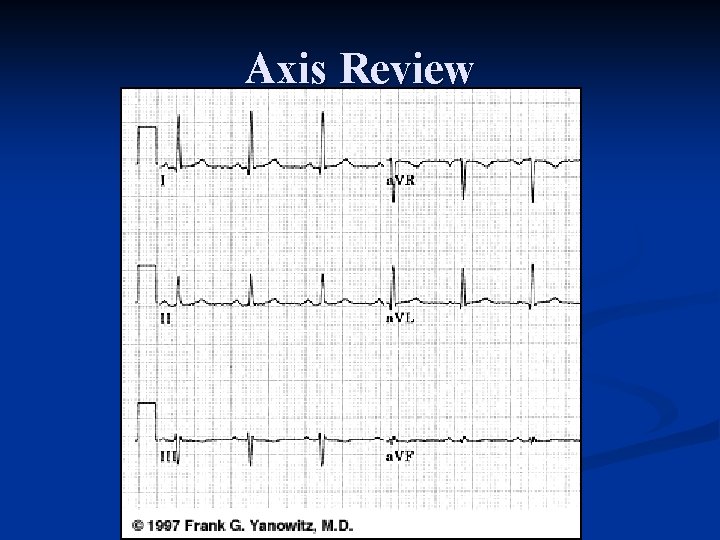 Axis Review 