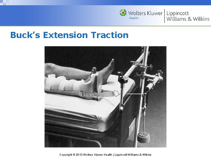 Buck’s Extension Traction Copyright © 2010 Wolters Kluwer Health | Lippincott Williams & Wilkins