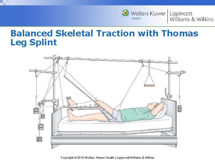 Balanced Skeletal Traction with Thomas Leg Splint Copyright © 2010 Wolters Kluwer Health |