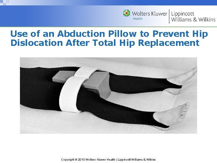 Use of an Abduction Pillow to Prevent Hip Dislocation After Total Hip Replacement Copyright