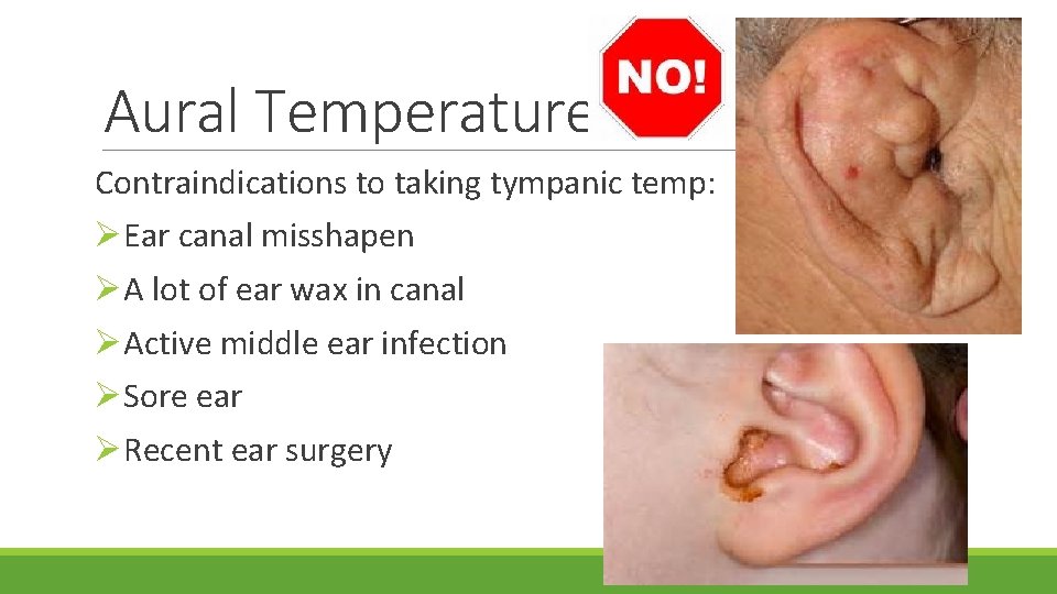 Aural Temperature Contraindications to taking tympanic temp: ØEar canal misshapen ØA lot of ear