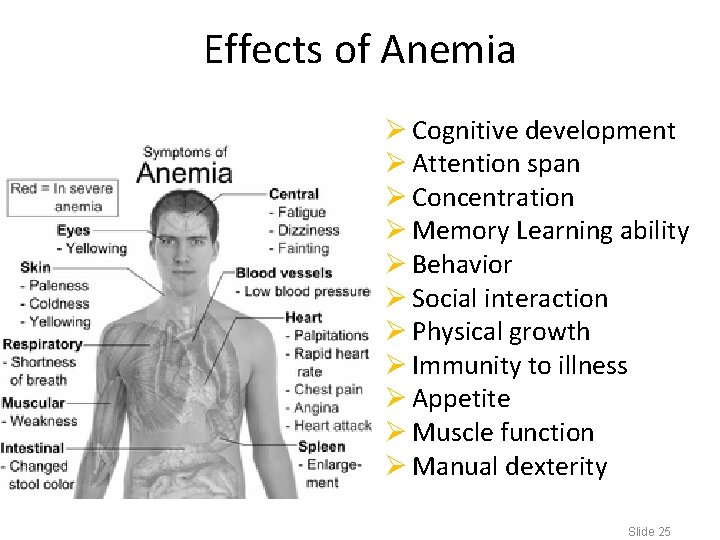 Effects of Anemia Ø Cognitive development Ø Attention span Ø Concentration Ø Memory Learning