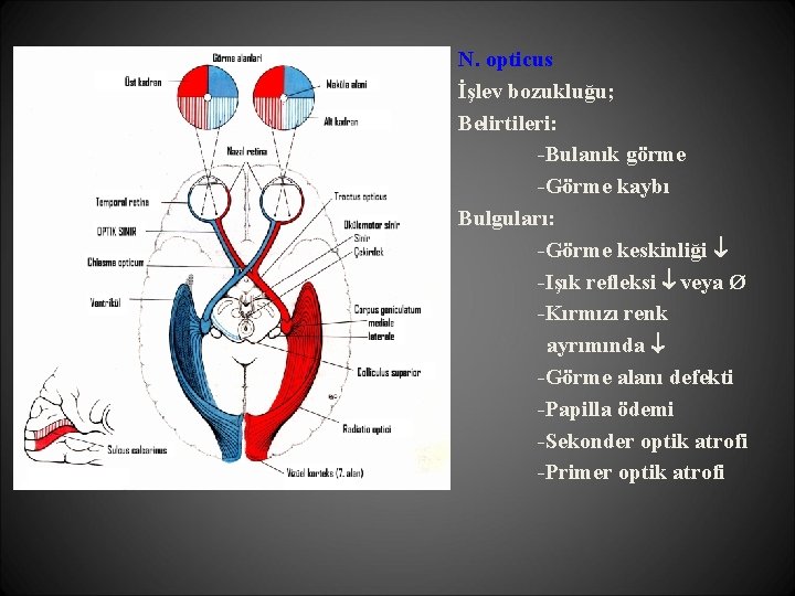 N. opticus İşlev bozukluğu; Belirtileri: -Bulanık görme -Görme kaybı Bulguları: -Görme keskinliği -Işık refleksi N. opticus İşlev bozukluğu; Belirtileri: -Bulanık görme -Görme kaybı Bulguları: -Görme keskinliği -Işık refleksi