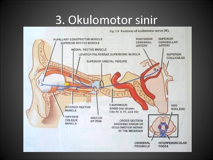 3. Okulomotor sinir 