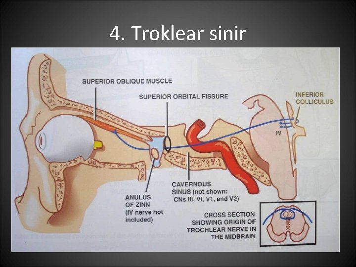 4. Troklear sinir 