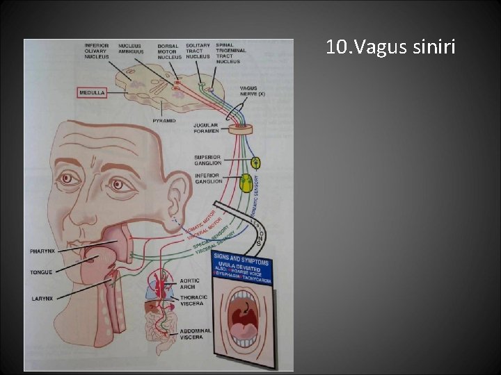 10. Vagus siniri 