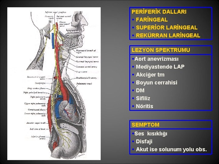 PERİFERİK DALLARI § FARİNGEAL § SUPERİOR LARİNGEAL § REKÜRRAN LARİNGEAL LEZYON SPEKTRUMU §Aort anevrizması