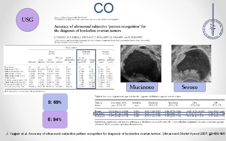 CO USG Mucinoso Seroso S: 69% E: 94% J. Yazbek et al. Accuracy of