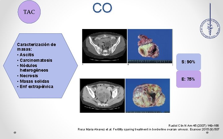 TAC Caracterización de masas: • Ascitis • Carcinomatosis • Nódulos heterogéneos • Necrosis •