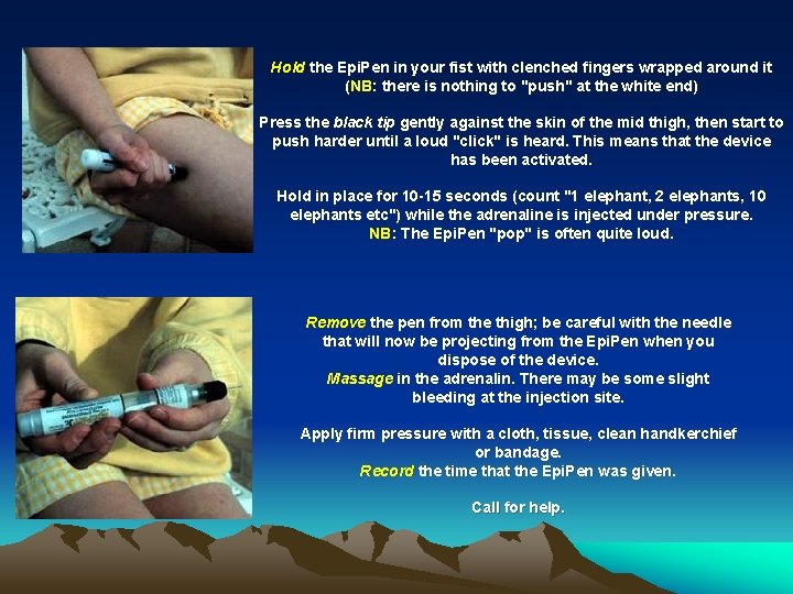 Hold the Epi. Pen in your fist with clenched fingers wrapped around it (NB: Hold the Epi. Pen in your fist with clenched fingers wrapped around it (NB: