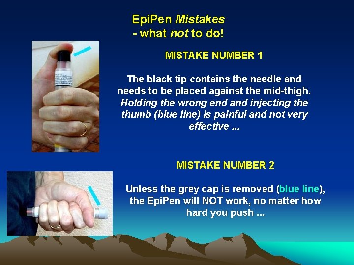 Epi. Pen Mistakes - what not to do! MISTAKE NUMBER 1 The black tip Epi. Pen Mistakes - what not to do! MISTAKE NUMBER 1 The black tip
