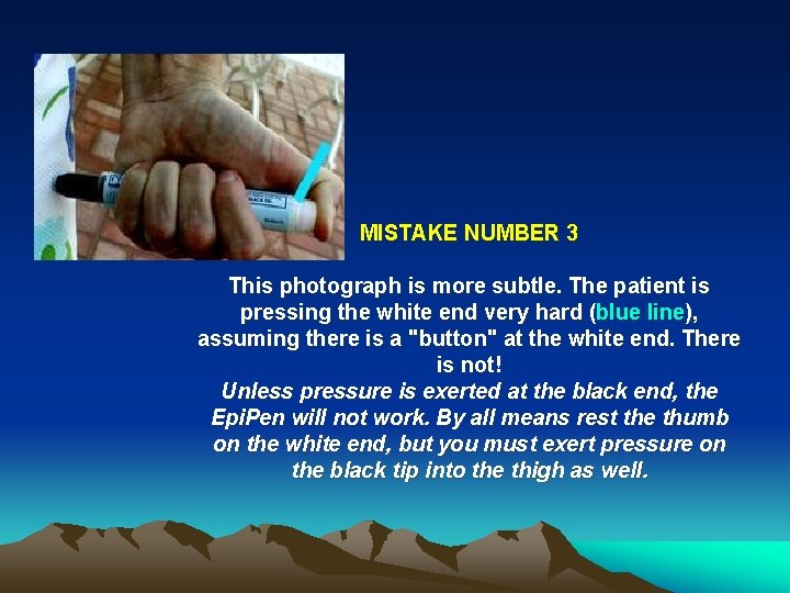 MISTAKE NUMBER 3 This photograph is more subtle. The patient is pressing the white MISTAKE NUMBER 3 This photograph is more subtle. The patient is pressing the white