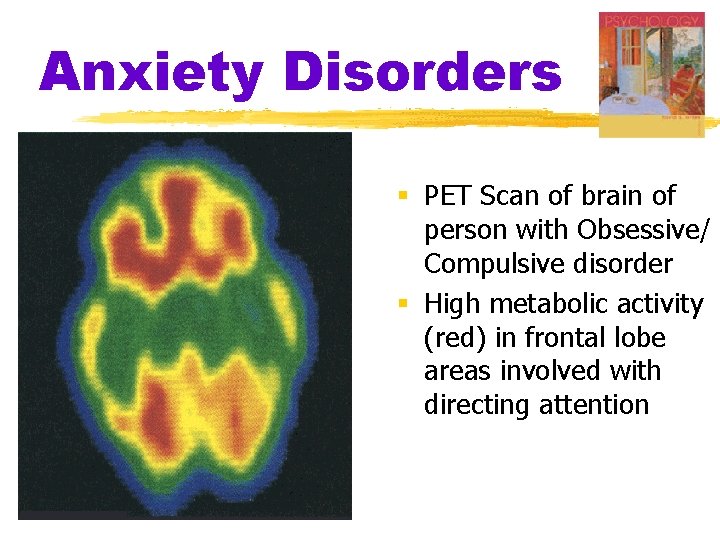 Anxiety Disorders § PET Scan of brain of person with Obsessive/ Compulsive disorder §
