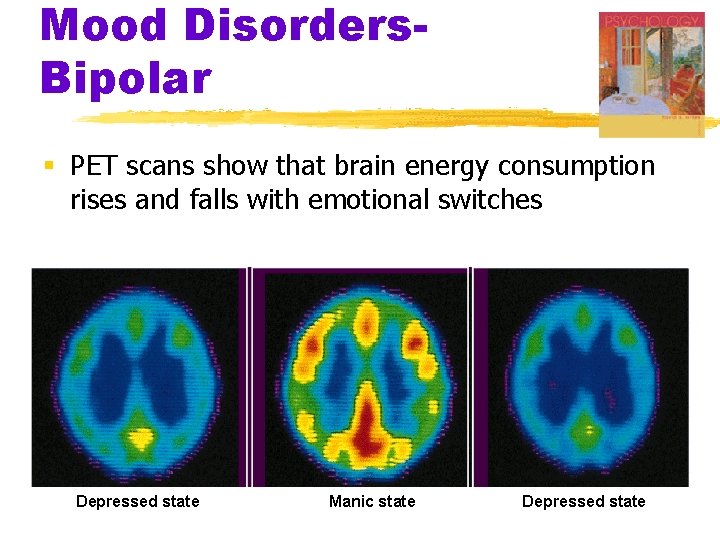 Mood Disorders. Bipolar § PET scans show that brain energy consumption rises and falls