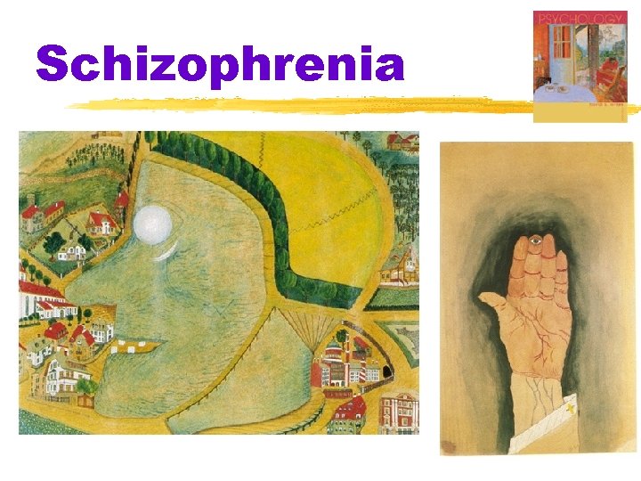 Schizophrenia 