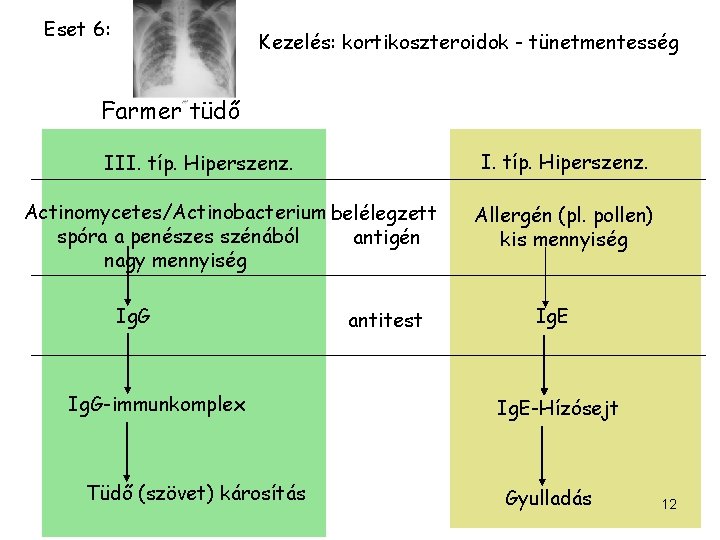Eset 6: Kezelés: kortikoszteroidok - tünetmentesség Farmer tüdő I. típ. Hiperszenz. III. típ. Hiperszenz.