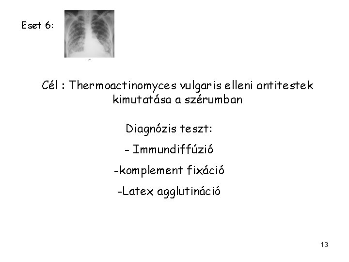 Eset 6: Cél : Thermoactinomyces vulgaris elleni antitestek kimutatása a szérumban Diagnózis teszt: -