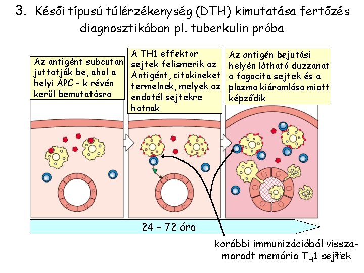 3. Késői típusú túlérzékenység (DTH) kimutatása fertőzés diagnosztikában pl. tuberkulin próba A TH 1