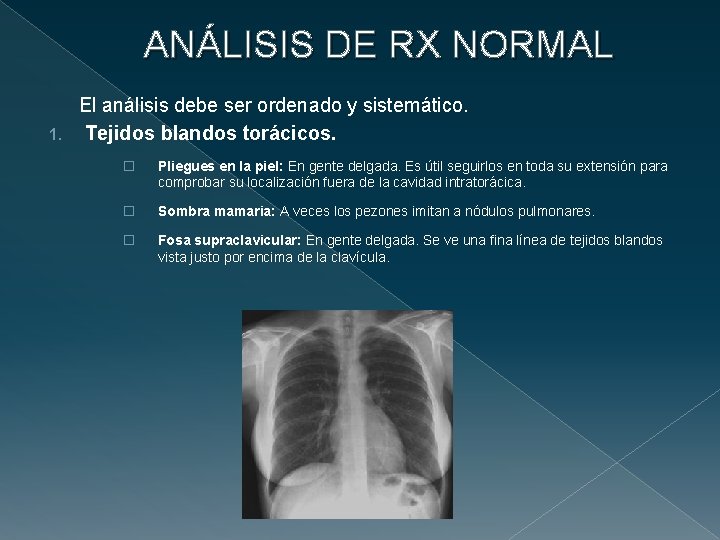 ANÁLISIS DE RX NORMAL El análisis debe ser ordenado y sistemático. 1. Tejidos blandos