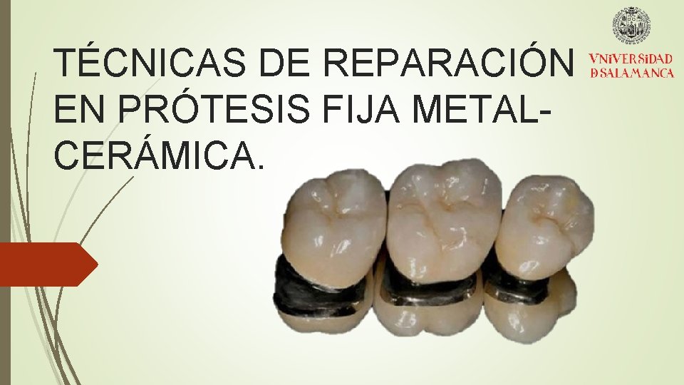 TÉCNICAS DE REPARACIÓN EN PRÓTESIS FIJA METALCERÁMICA. 