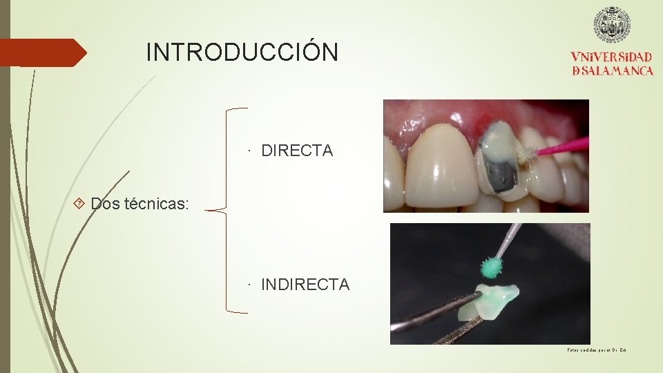 INTRODUCCIÓN · DIRECTA Dos técnicas: · INDIRECTA Fotos cedidas por el Dr. Cib 