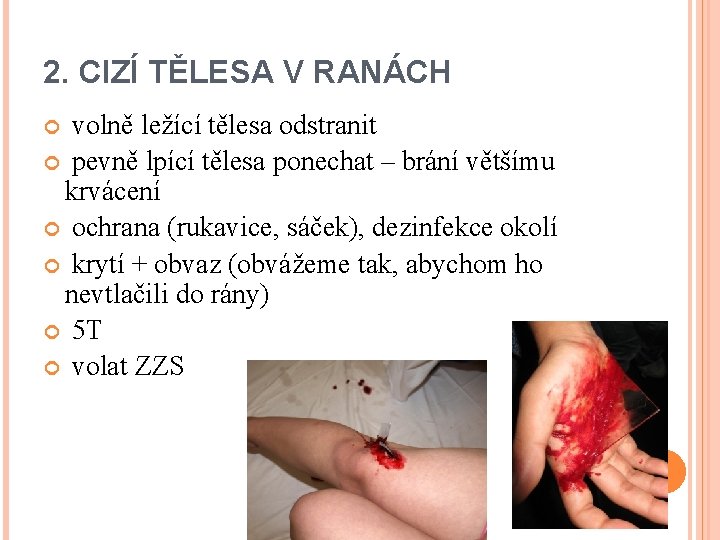 2. CIZÍ TĚLESA V RANÁCH volně ležící tělesa odstranit pevně lpící tělesa ponechat –