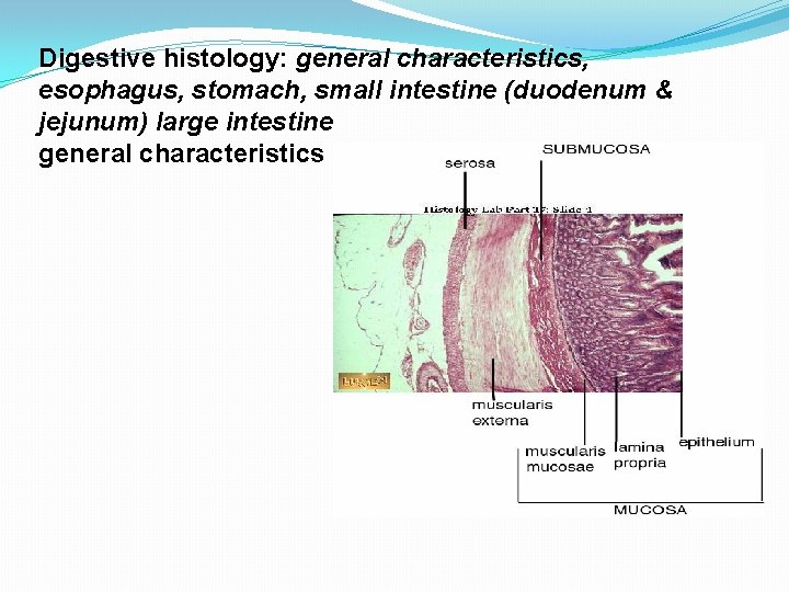 Digestive histology: general characteristics, esophagus, stomach, small intestine (duodenum & jejunum) large intestine general