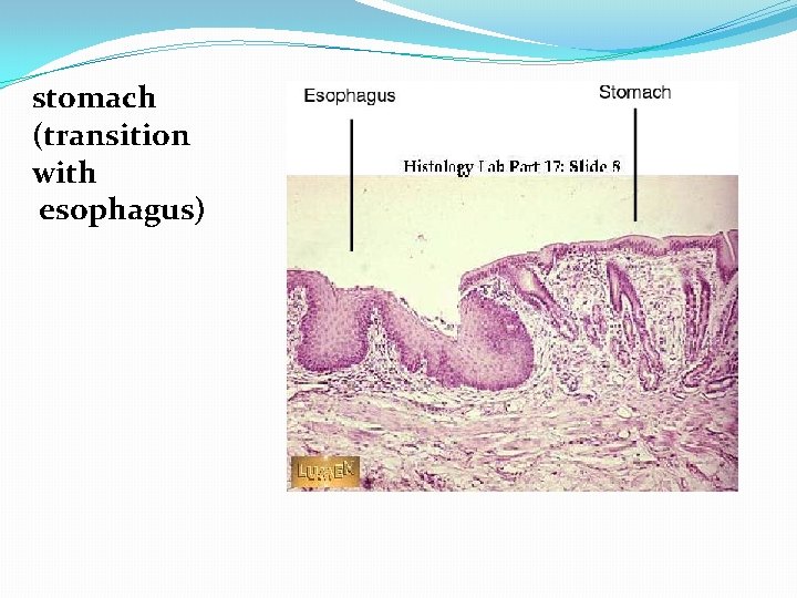 stomach (transition with esophagus) 