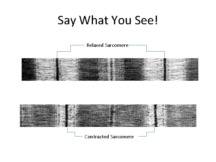 Say What You See! Relaxed Sarcomere Contracted Sarcomere 