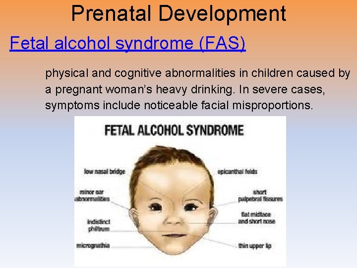 Prenatal Development Fetal alcohol syndrome (FAS) physical and cognitive abnormalities in children caused by