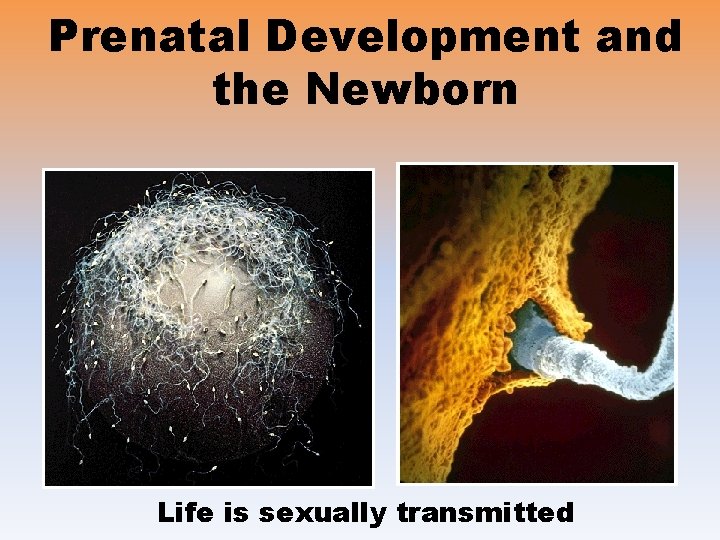 Prenatal Development and the Newborn Life is sexually transmitted 